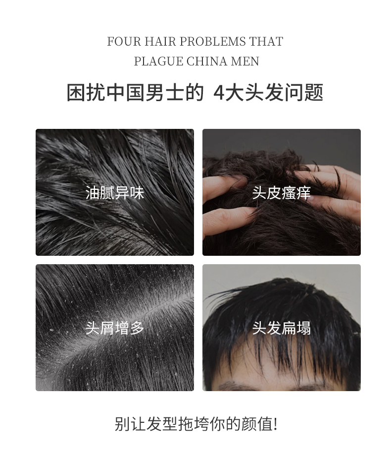 困擾中國男士的四大問題，油膩異味、頭皮瘙癢、頭屑增多、頭發扁塌